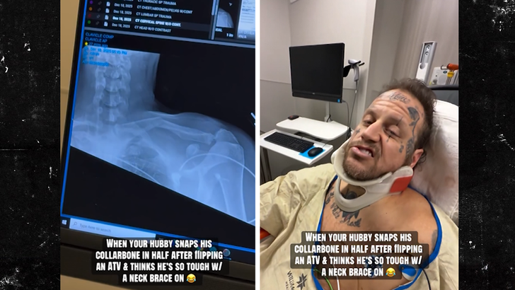 Jelly Roll Was at Grammys With a Broken Collarbone From ATV Crash, Bunnie Posts Vid